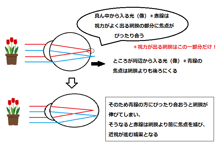 近視が進む理由